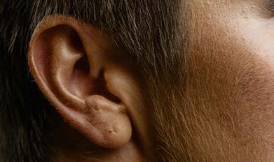 耳朵经常痒，是怎么回事？
